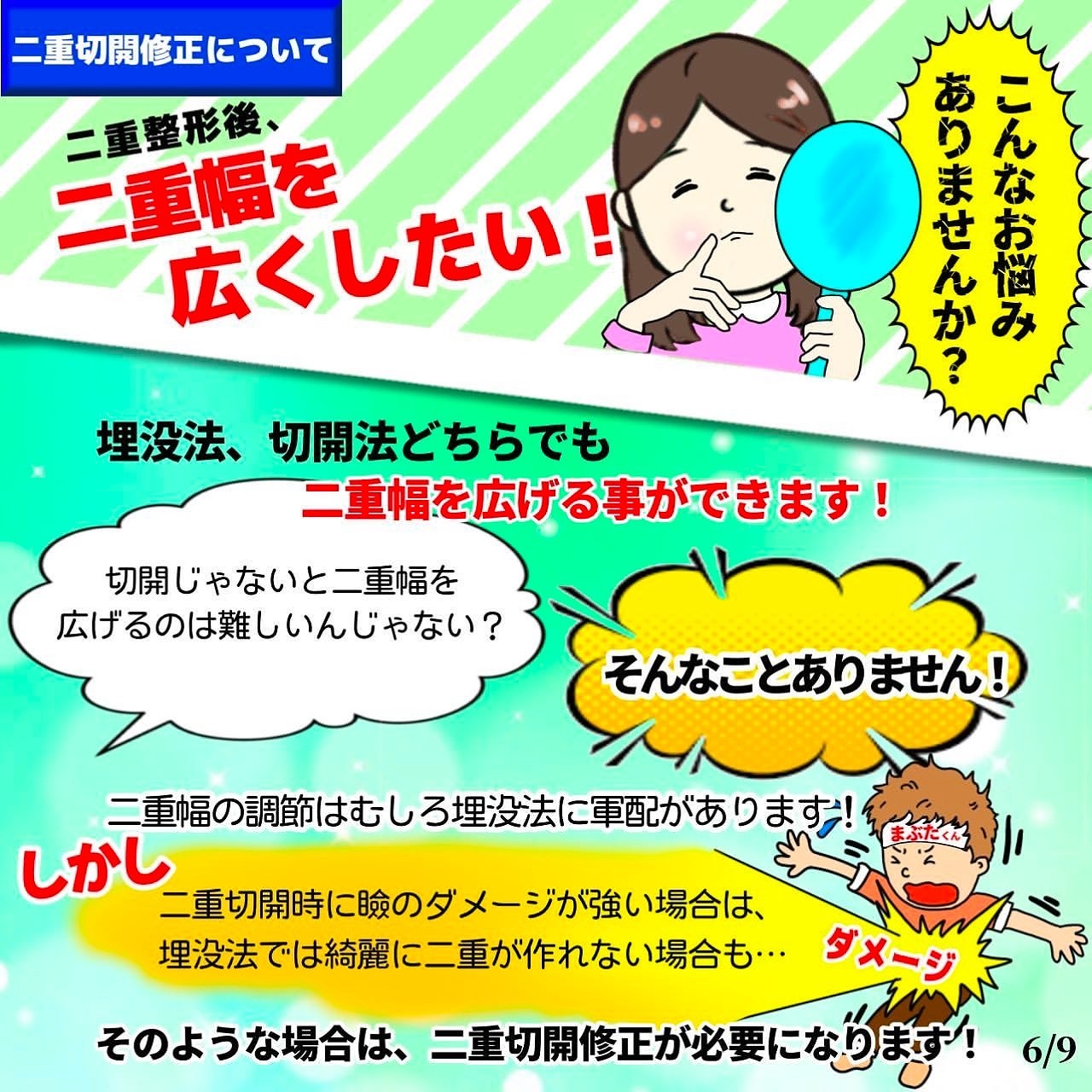 二重切開修正　幅を広くしたい